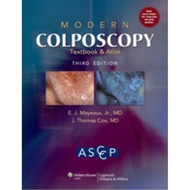 Modern Colposcopy Textbook and Atlas